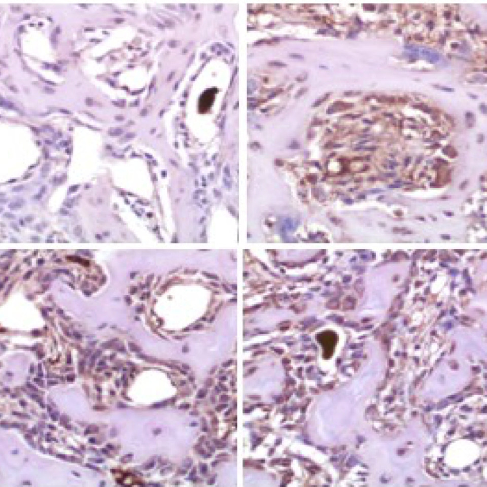 Stem Cell Plasticity in Tissue Repair and Regeneration - PLOS Collections