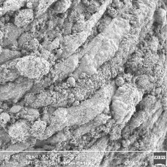 Stem Cell Plasticity in Tissue Repair and Regeneration - PLOS Collections
