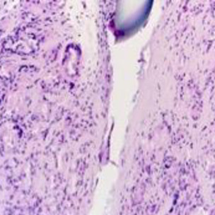 Stem Cell Plasticity in Tissue Repair and Regeneration - PLOS Collections