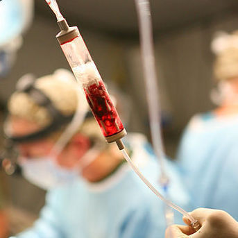 Traumatic Injury - PLOS Collections